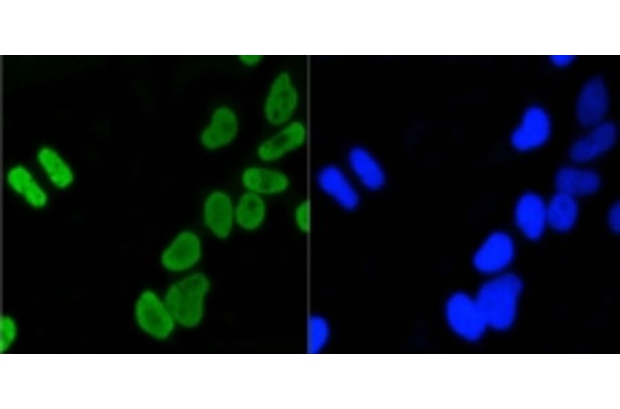 Anti-Histone H4 (Acetyl-K5) Antibody from Bioworld Technology (BS9867M) - Antibodies.com
