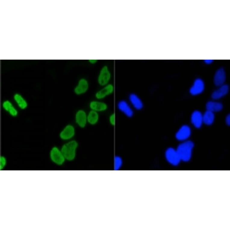 Anti-Histone H4 (Acetyl-K5) Antibody from Bioworld Technology (BS9867M) - Antibodies.com