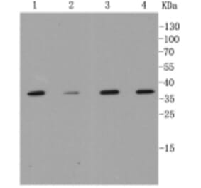 Anti-MMP12 Antibody from Bioworld Technology (BS9869M) - Antibodies.com