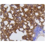 Anti-MMP12 Antibody from Bioworld Technology (BS9869M) - Antibodies.com