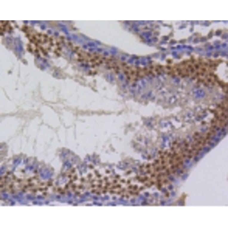 Anti-Survivin Antibody from Bioworld Technology (BS9870M) - Antibodies.com