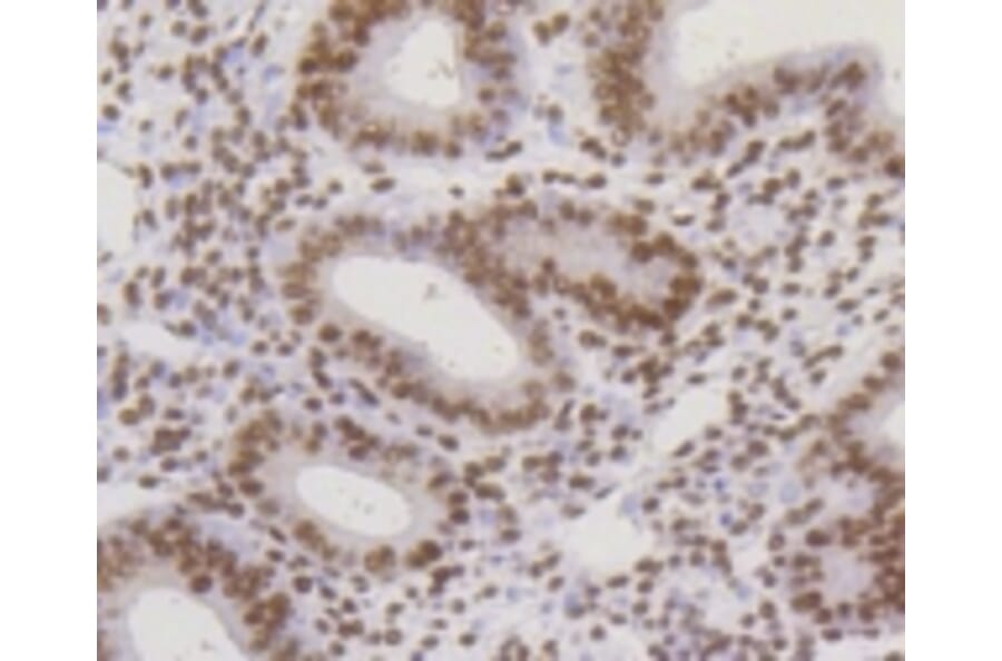 Anti-CBX5 Antibody from Bioworld Technology (BS9876M) - Antibodies.com