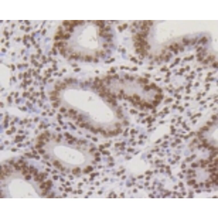 Anti-CBX5 Antibody from Bioworld Technology (BS9876M) - Antibodies.com