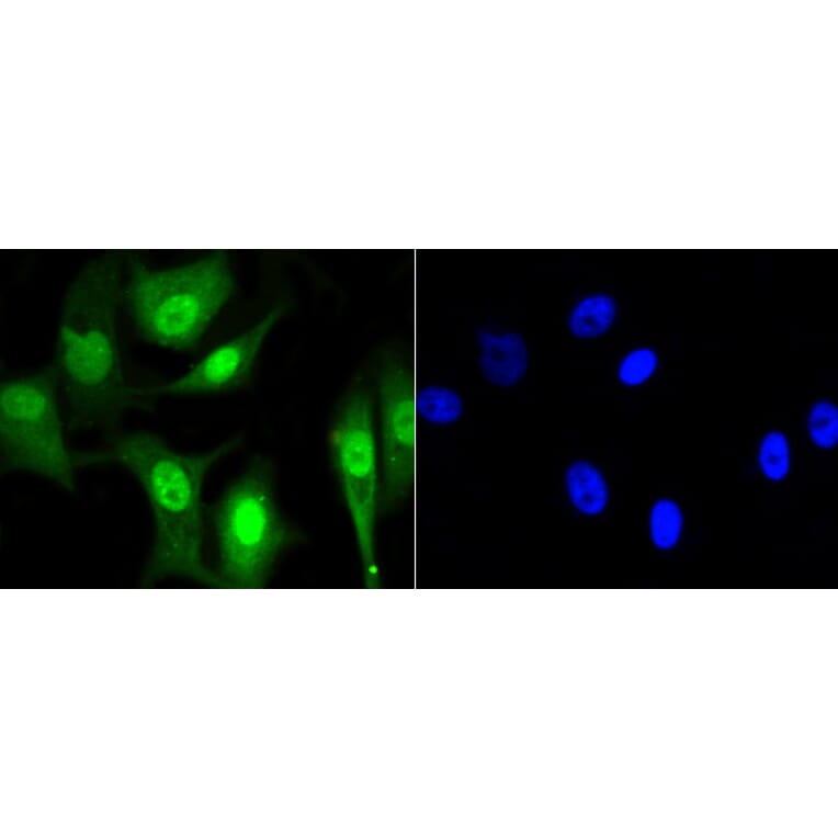 Anti-CBX5 Antibody from Bioworld Technology (BS9876M) - Antibodies.com
