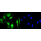 Anti-CBX5 Antibody from Bioworld Technology (BS9876M) - Antibodies.com