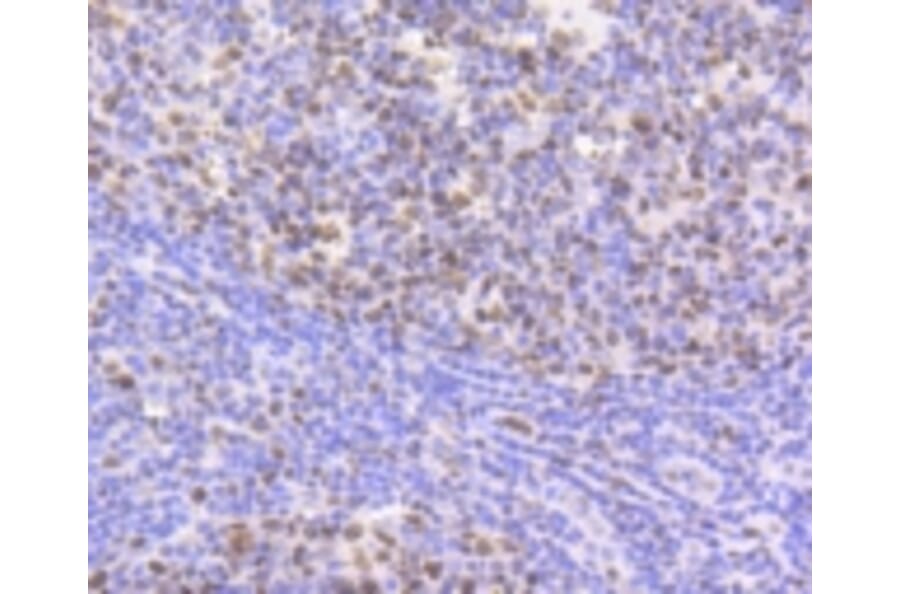 Anti-CBX5 Antibody from Bioworld Technology (BS9876M) - Antibodies.com