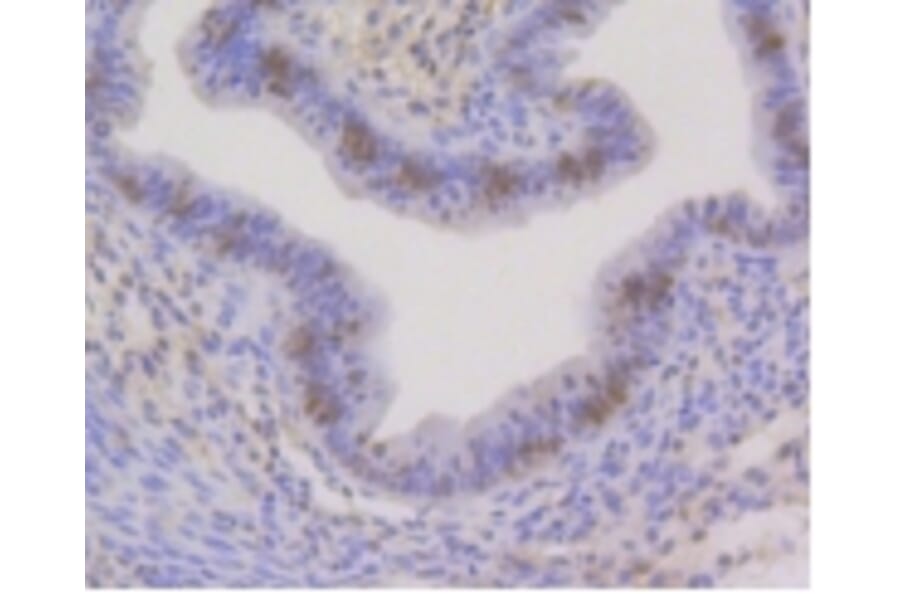 Anti-CBX5 Antibody from Bioworld Technology (BS9876M) - Antibodies.com