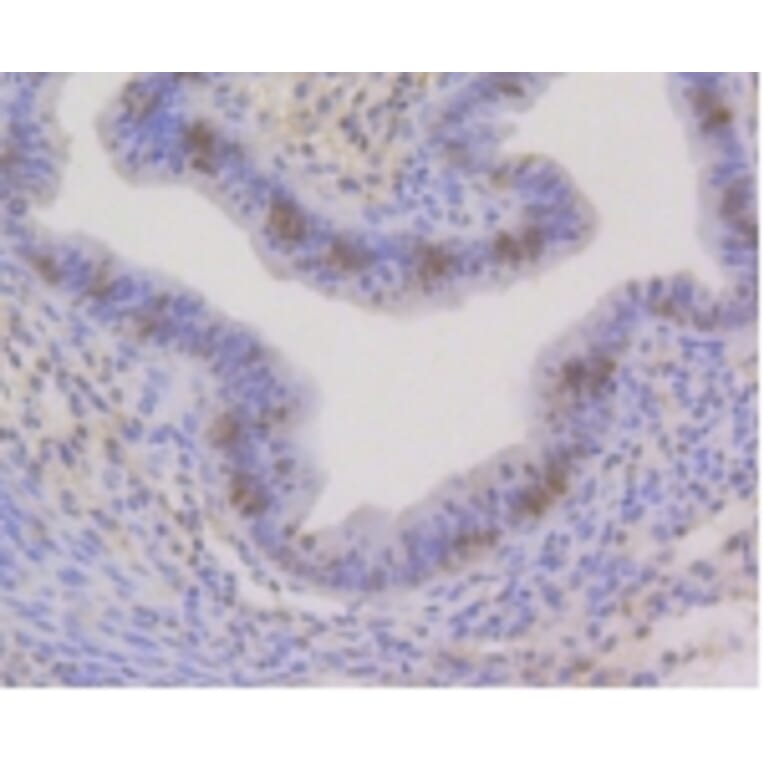 Anti-CBX5 Antibody from Bioworld Technology (BS9876M) - Antibodies.com