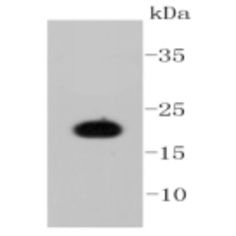 Anti-Caveolin-1 Antibody from Bioworld Technology (BS9878M) - Antibodies.com