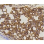 Anti-Caveolin-1 Antibody from Bioworld Technology (BS9878M) - Antibodies.com