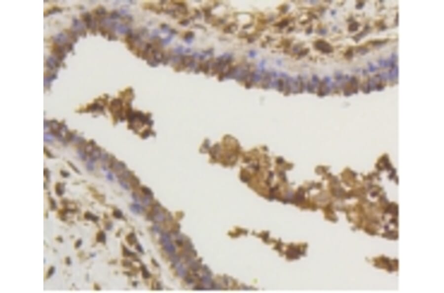 Anti-NF-kB p65 Antibody from Bioworld Technology (BS9879M) - Antibodies.com