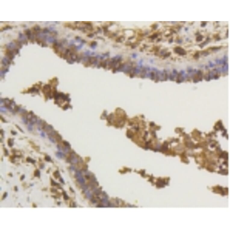 Anti-NF-kB p65 Antibody from Bioworld Technology (BS9879M) - Antibodies.com