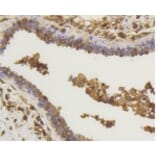 Anti-NF-kB p65 Antibody from Bioworld Technology (BS9879M) - Antibodies.com