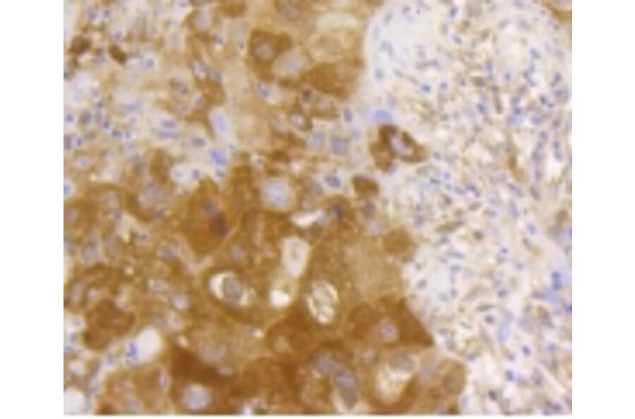 Anti-NF-kB p65 Antibody from Bioworld Technology (BS9879M) - Antibodies.com