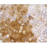 Anti-NF-kB p65 Antibody from Bioworld Technology (BS9879M) - Antibodies.com