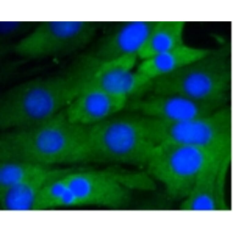 Anti-NF-kB p65 Antibody from Bioworld Technology (BS9879M) - Antibodies.com