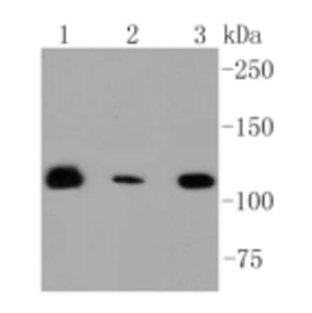 Anti-RNF20 Antibody from Bioworld Technology (BS9884M) - Antibodies.com