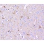 Anti-PDGFR-β Antibody from Bioworld Technology (BS9886M) - Antibodies.com