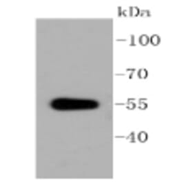 Anti-ALDH1A1 Antibody from Bioworld Technology (BS9887M) - Antibodies.com