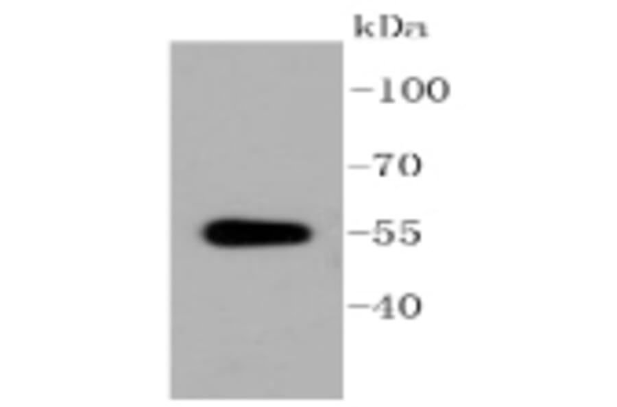 Anti-ALDH1A1 Antibody from Bioworld Technology (BS9887M) - Antibodies.com