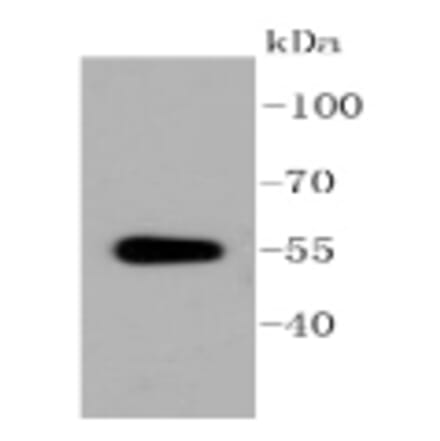 Anti-ALDH1A1 Antibody from Bioworld Technology (BS9887M) - Antibodies.com