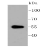 Anti-ALDH1A1 Antibody from Bioworld Technology (BS9887M) - Antibodies.com