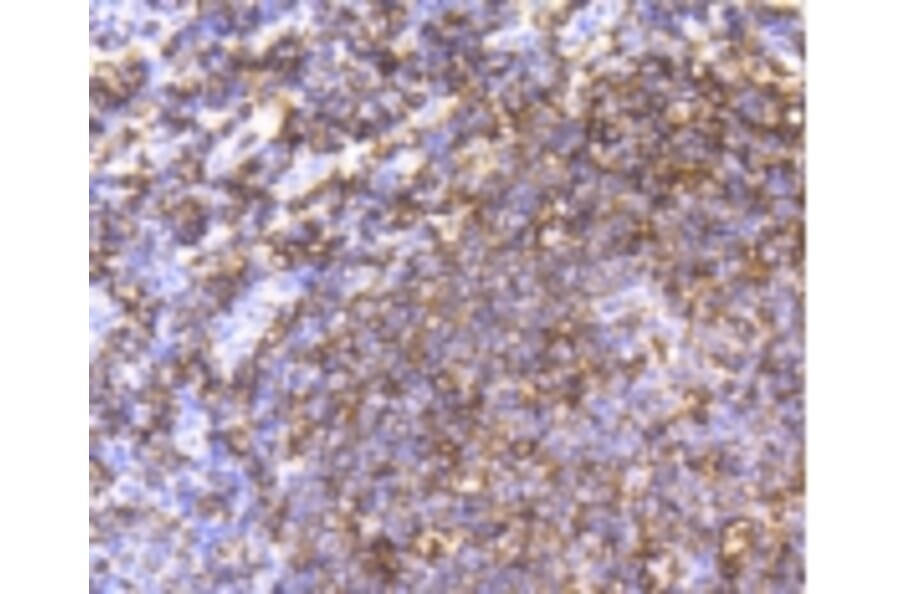 Anti-CD20 Antibody from Bioworld Technology (BS9888M) - Antibodies.com