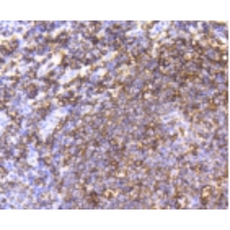 Anti-CD20 Antibody from Bioworld Technology (BS9888M) - Antibodies.com