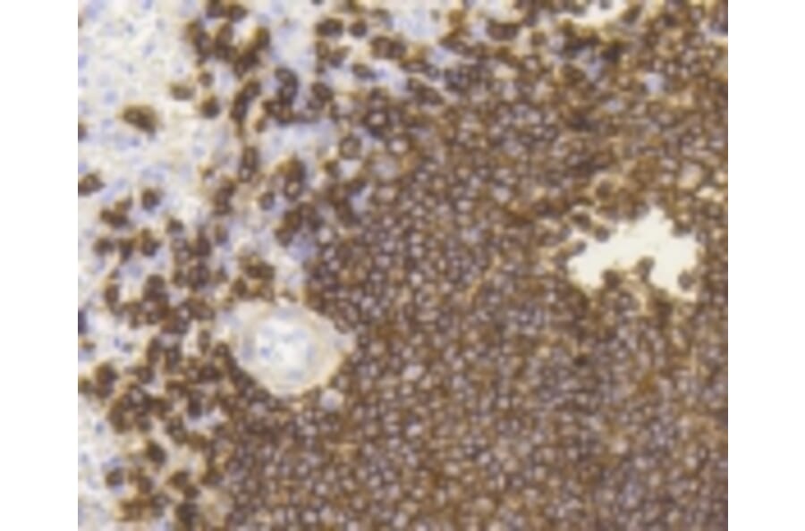 Anti-CD20 Antibody from Bioworld Technology (BS9888M) - Antibodies.com