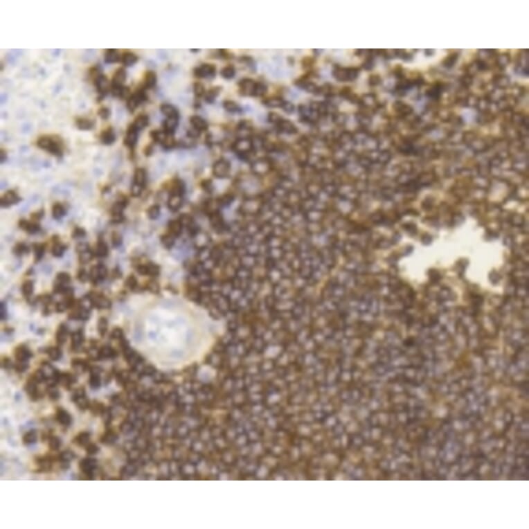 Anti-CD20 Antibody from Bioworld Technology (BS9888M) - Antibodies.com