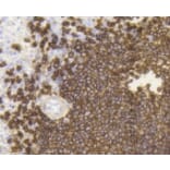 Anti-CD20 Antibody from Bioworld Technology (BS9888M) - Antibodies.com