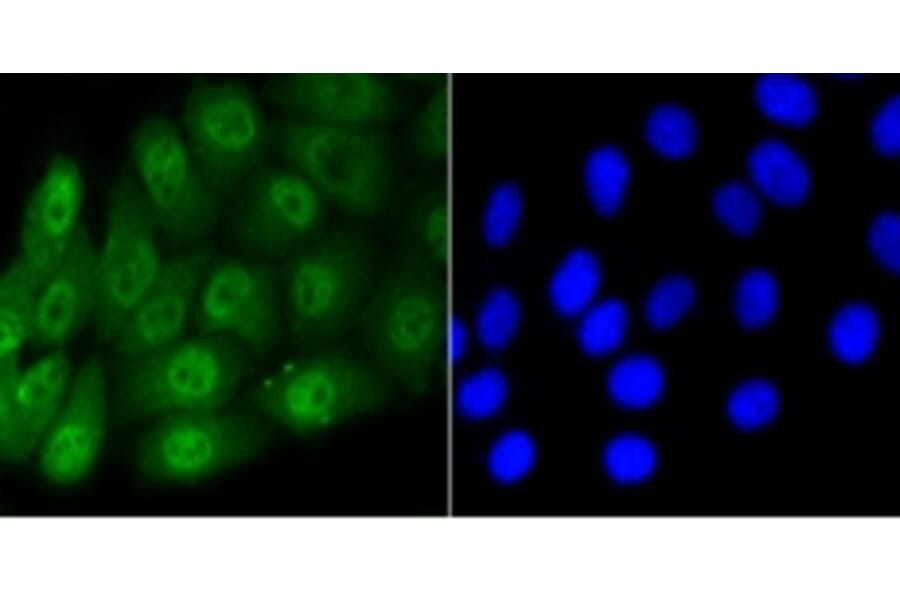 Anti-Smad 5 (phospho-S463/465) Antibody from Bioworld Technology (BS9889M) - Antibodies.com