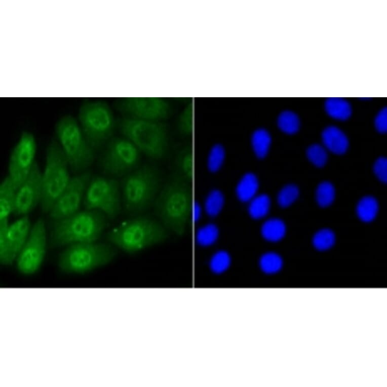Anti-Smad 5 (phospho-S463/465) Antibody from Bioworld Technology (BS9889M) - Antibodies.com