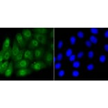 Anti-Smad 5 (phospho-S463/465) Antibody from Bioworld Technology (BS9889M) - Antibodies.com