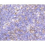 Anti-Smad 5 (phospho-S463/465) Antibody from Bioworld Technology (BS9889M) - Antibodies.com
