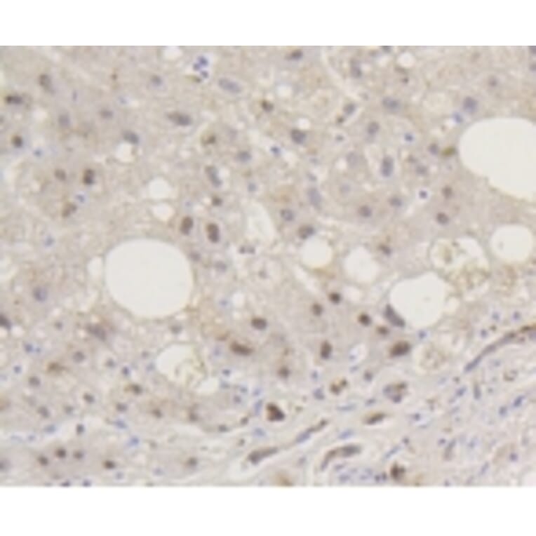 Anti-Smad 5 (phospho-S463/465) Antibody from Bioworld Technology (BS9889M) - Antibodies.com