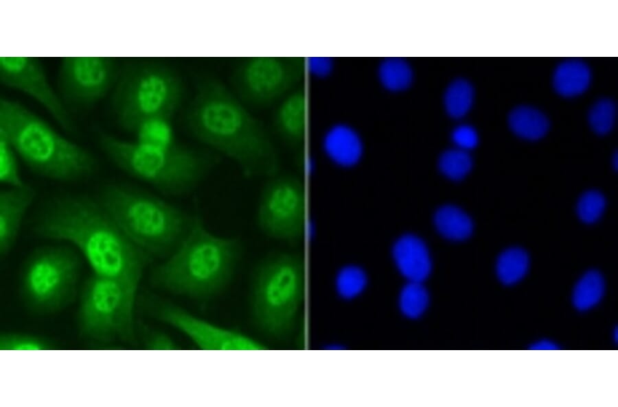 Anti-Smad 5 (phospho-S463/465) Antibody from Bioworld Technology (BS9889M) - Antibodies.com