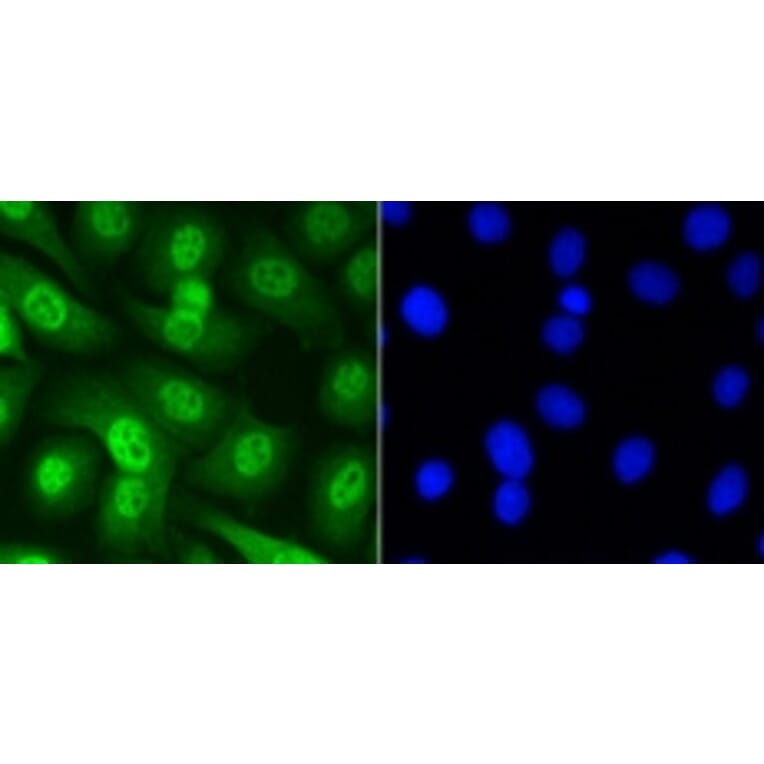 Anti-Smad 5 (phospho-S463/465) Antibody from Bioworld Technology (BS9889M) - Antibodies.com