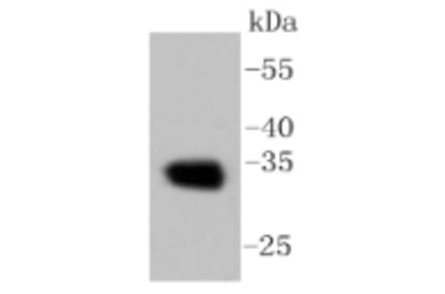 Anti-CNN1 Antibody from Bioworld Technology (BS9892M) - Antibodies.com