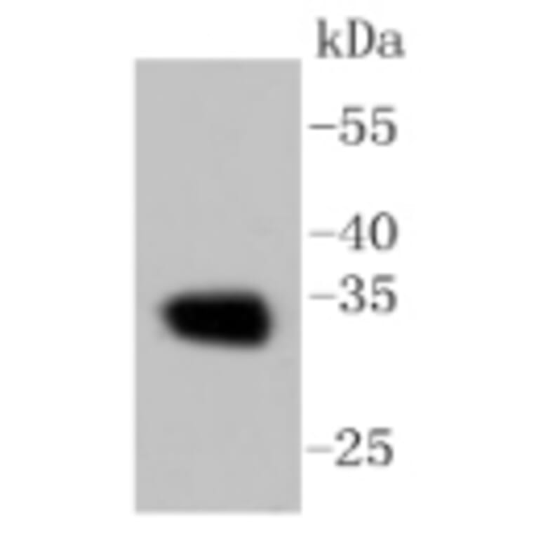 Anti-CNN1 Antibody from Bioworld Technology (BS9892M) - Antibodies.com