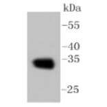 Anti-CNN1 Antibody from Bioworld Technology (BS9892M) - Antibodies.com