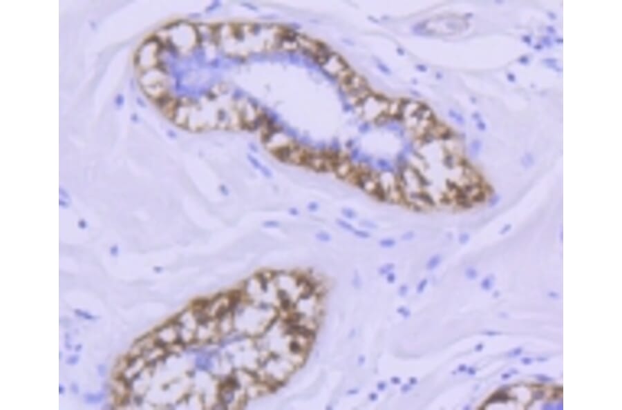 Anti-CNN1 Antibody from Bioworld Technology (BS9892M) - Antibodies.com
