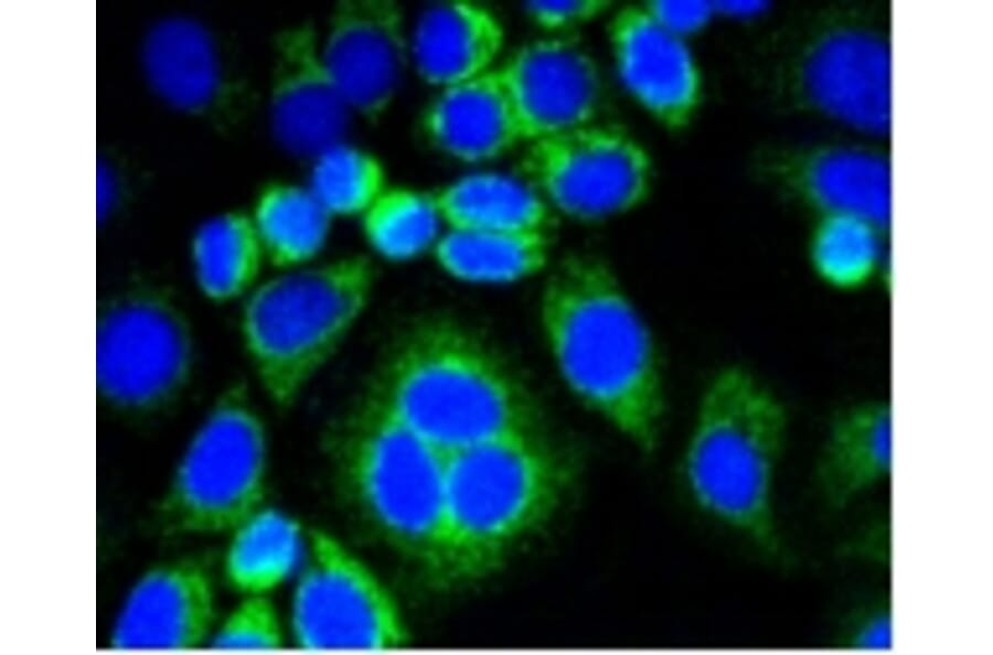 Anti-CNN1 Antibody from Bioworld Technology (BS9892M) - Antibodies.com