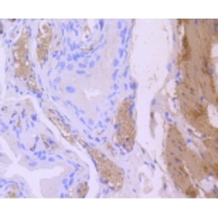 Anti-CNN1 Antibody from Bioworld Technology (BS9892M) - Antibodies.com