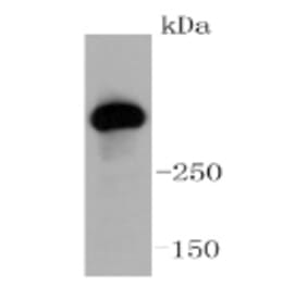 Anti-ATM Antibody from Bioworld Technology (BS9893M) - Antibodies.com