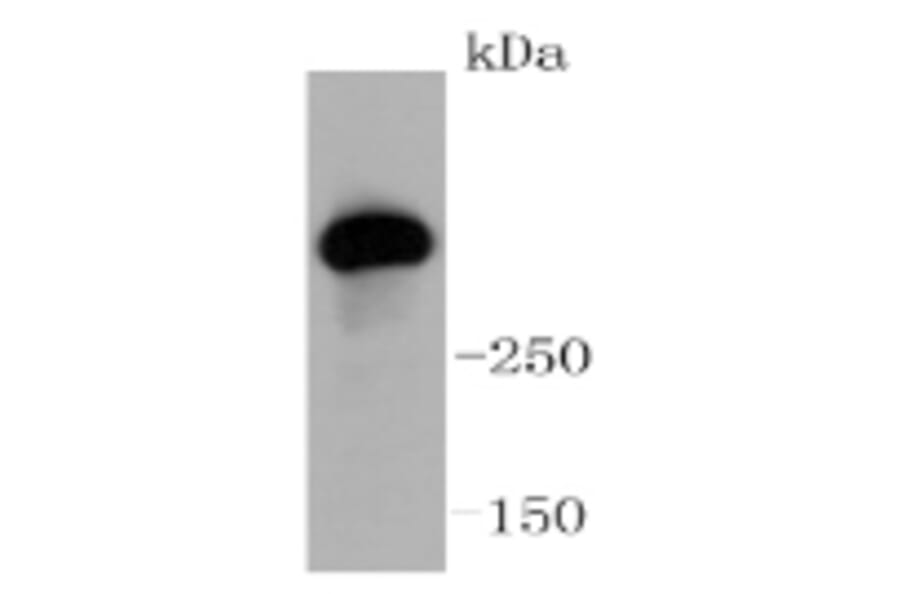 Anti-ATM Antibody from Bioworld Technology (BS9893M) - Antibodies.com