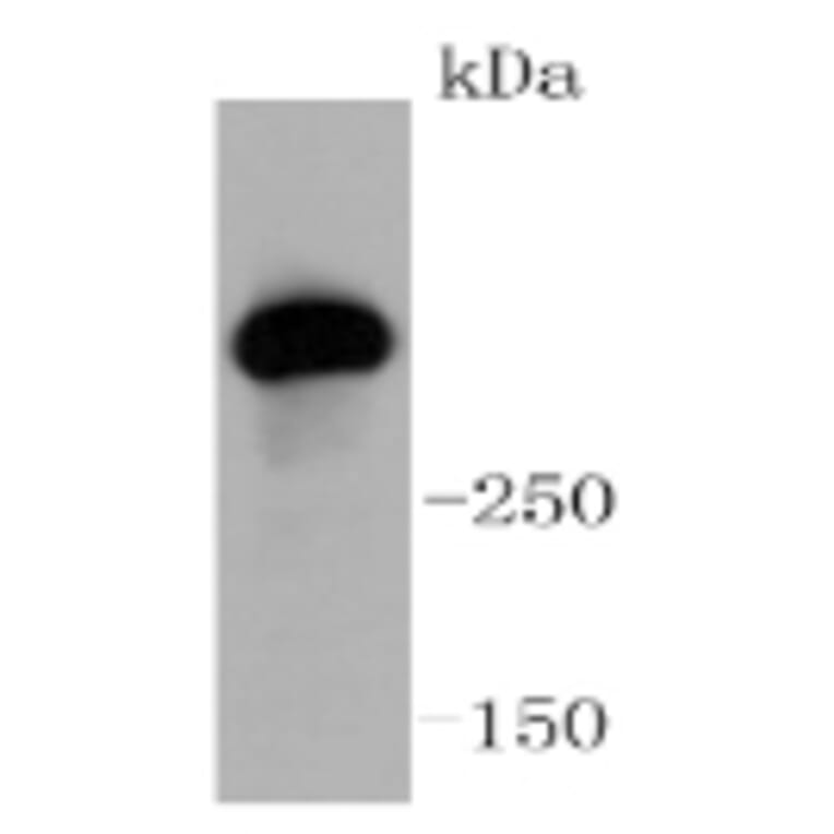 Anti-ATM Antibody from Bioworld Technology (BS9893M) - Antibodies.com