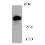 Anti-ATM Antibody from Bioworld Technology (BS9893M) - Antibodies.com