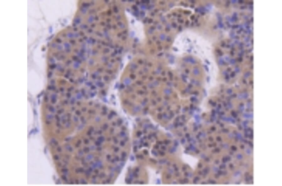 Anti-ATM Antibody from Bioworld Technology (BS9893M) - Antibodies.com