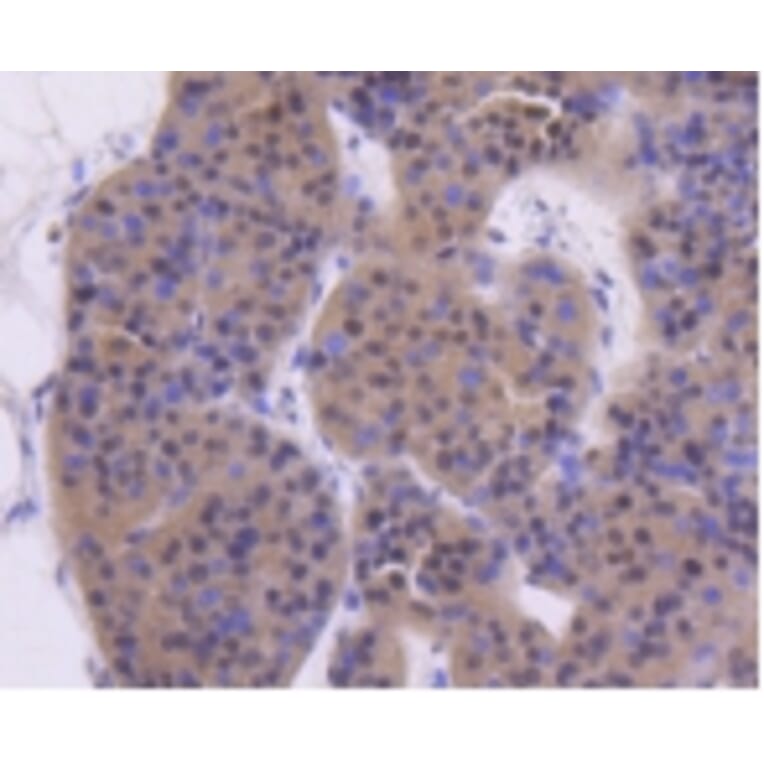 Anti-ATM Antibody from Bioworld Technology (BS9893M) - Antibodies.com